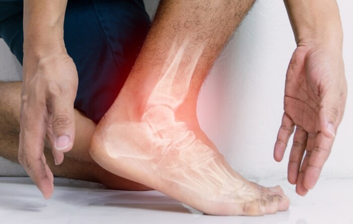 Ankle Surgery at Southern Delaware Foot & Ankle