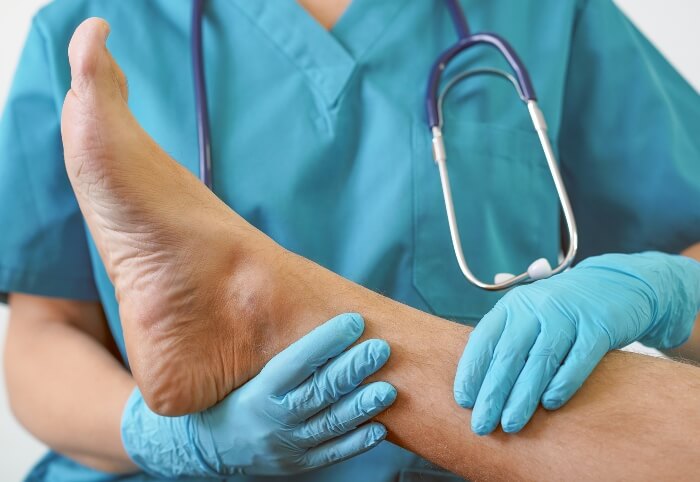 Doctor Checking Foot for Geratic Infection
